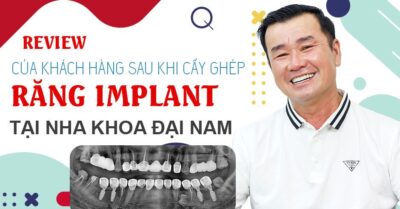 Review của khách hàng sau khi cấy ghép răng Implant tại Trung tâm Nha khoa Đại Nam