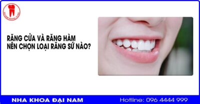 Nên chọn loại răng sứ nào cho răng cửa, răng hàm là tốt và đẹp nhất?