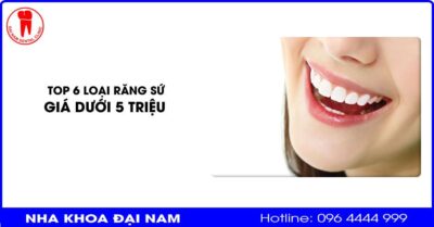 Top 6 loại răng sứ giá dưới 5 triệu có chất lượng tốt nhất
