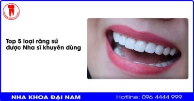 Bọc răng sứ loại nào tốt? Top 5 loại răng sứ được Nha sĩ khuyên dùng