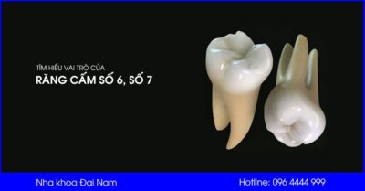 Tìm hiểu răng cấm số 6, số 7 | Tác hại khi mất răng cấm | Cách điều trị răng cấm bị sâu