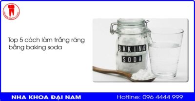 Top 5 cách làm trắng răng bằng baking soda dễ dàng thực hiện ngay tại nhà